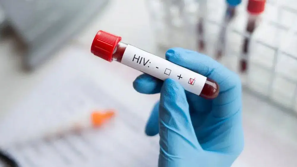 Türkiye’de HIV gerçeği: 10 yılda yüzde 460 arttı